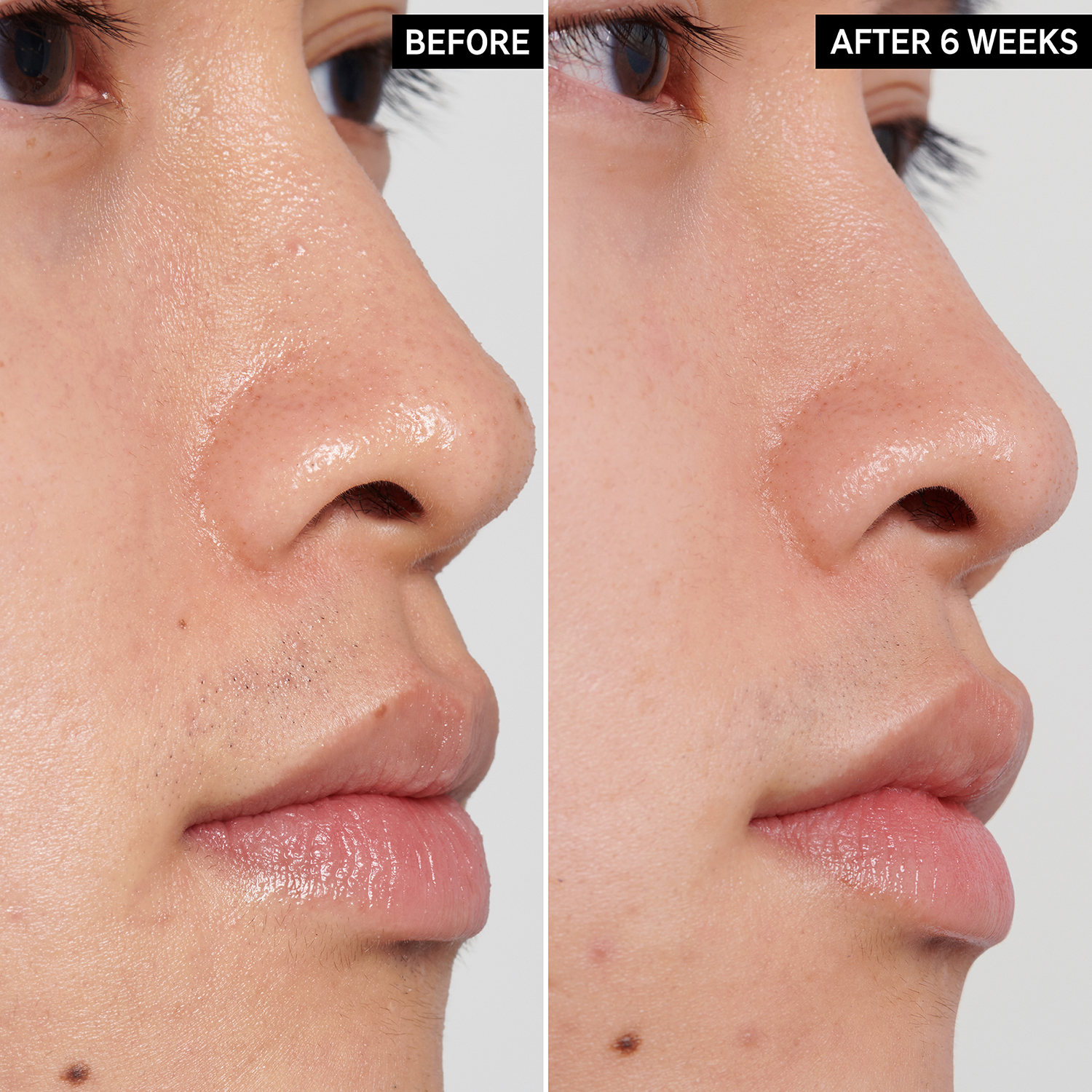 POLYHYDROXY ACID GENTLE EXFOLIATING TONER (TÓNICO EXFOLIANTE SUAVE)